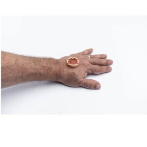 Healing Spacer - Image 3